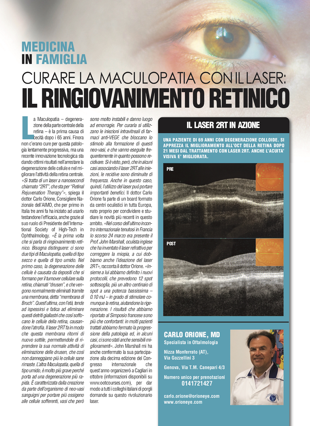 Curare la maculopatia conillaser: il ringiovanimento retinico
